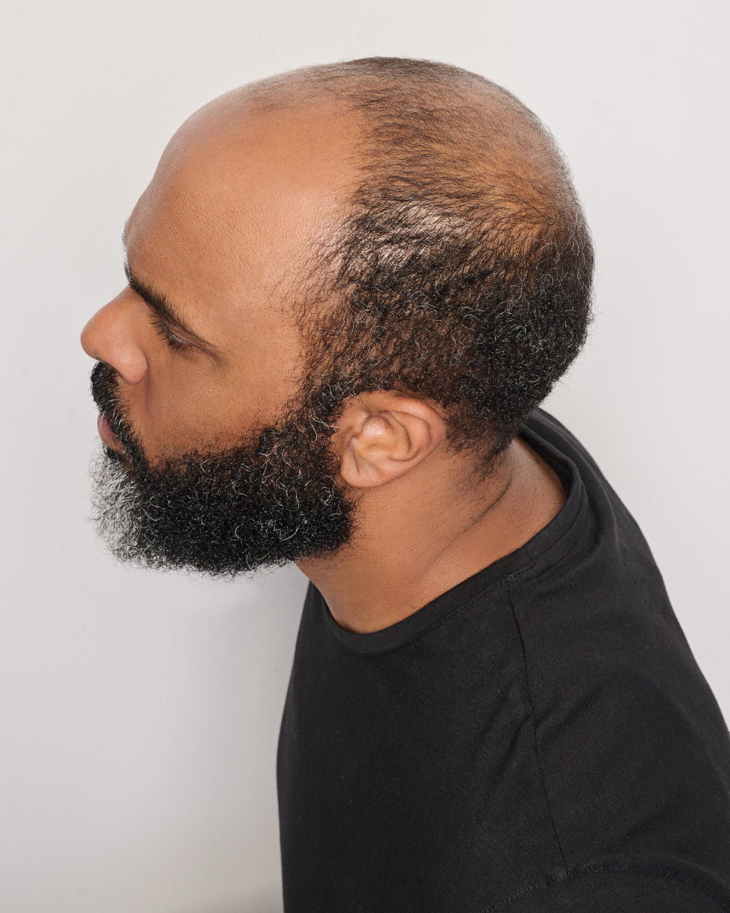 Dignified | Him by HairUWear | Before view