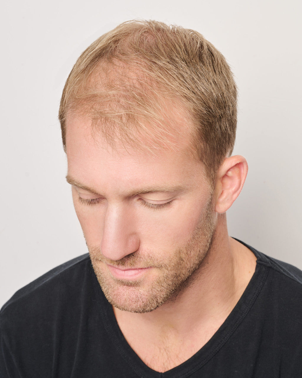 Dignified | Him by HairUWear | Before view